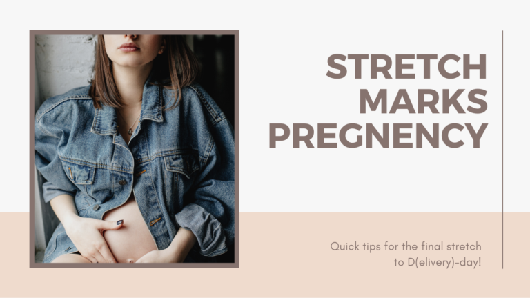 Stretch marks Pregnancy| Removal tips